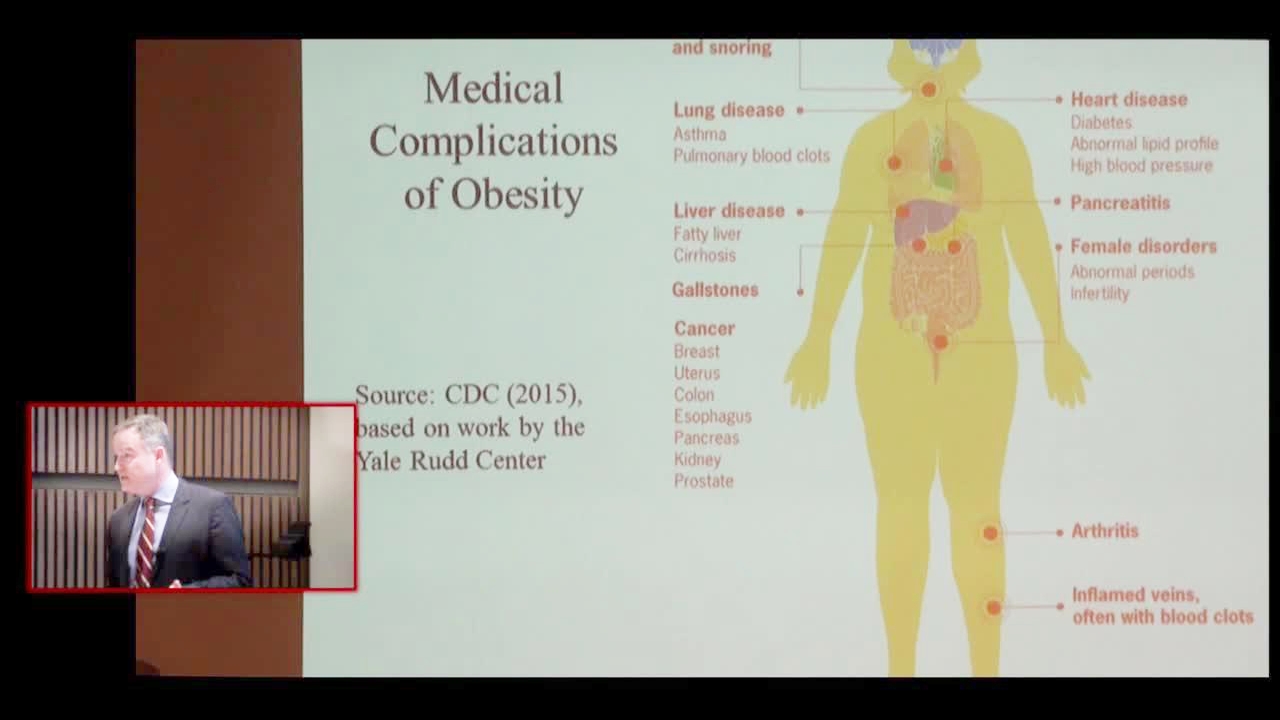 The Price Per Pound Exploring the Economics of Obesity Cornell Video