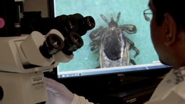 scientist uses a microscope to examine a tick