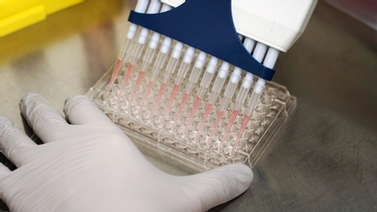 A gloved hand performs lab work.